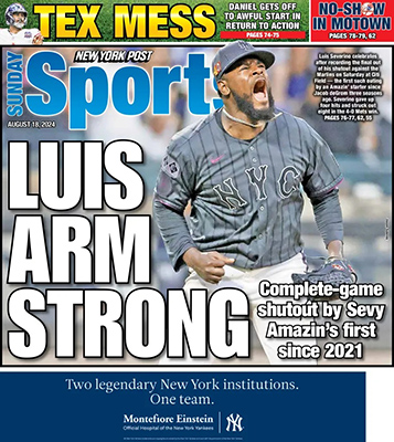 LUIS ARM STRONG